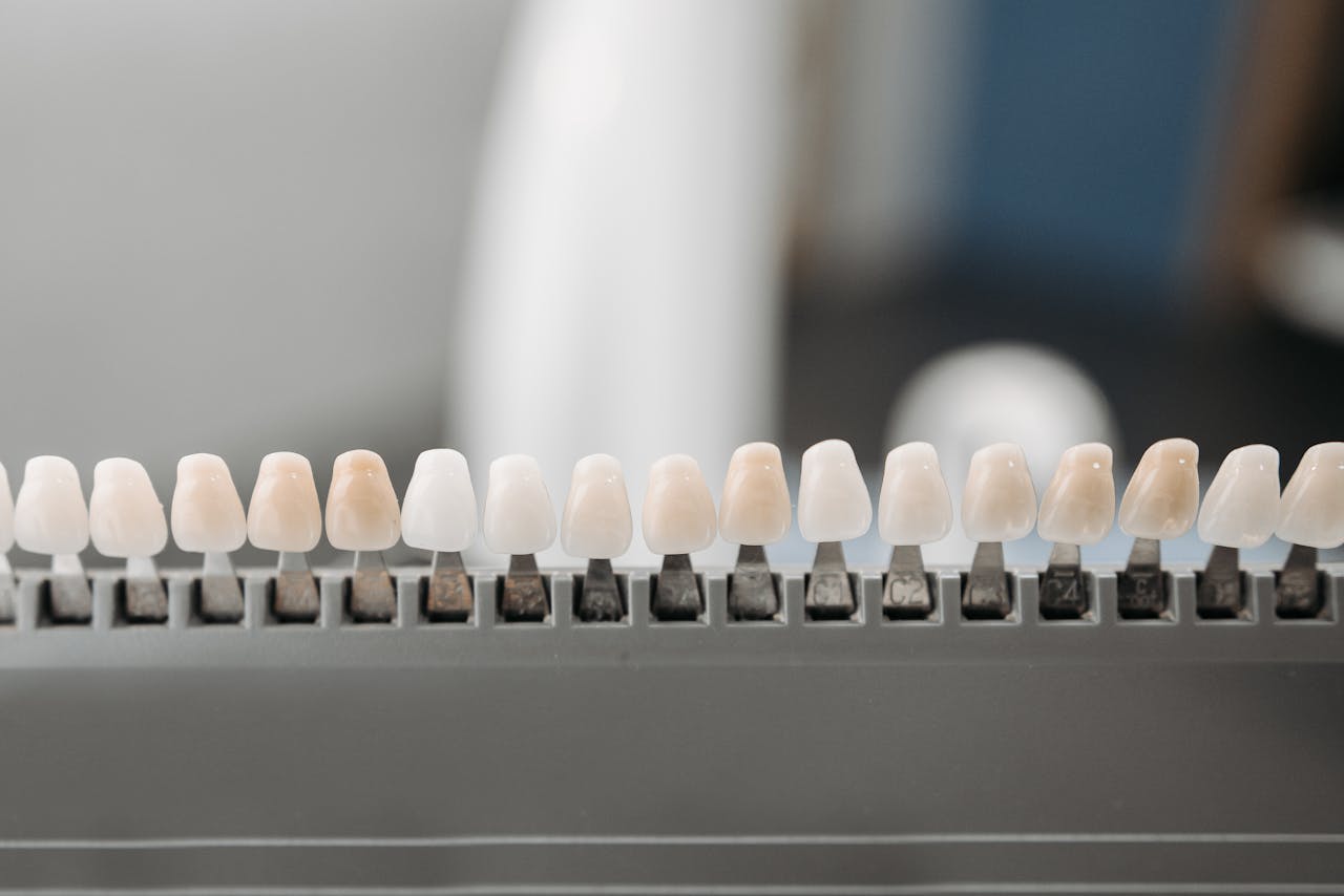 Close-up of dental veneers arranged neatly on a display rack in a dental office setting.